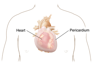 Front view of male chest showing heart inside pericardium. 