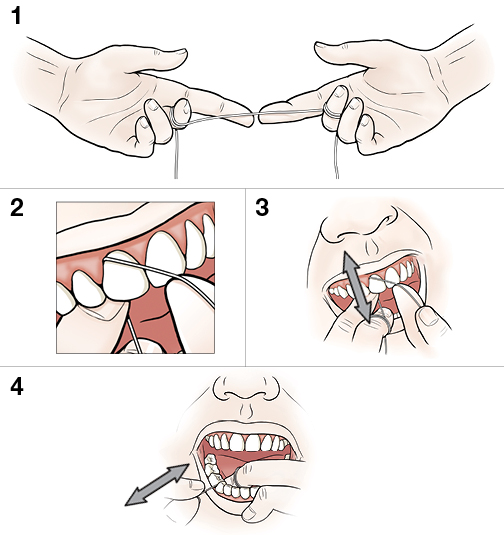 4 pasos para usar hilo dental