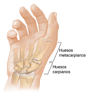 Vista de la palma de la mano donde se observan los huesos metacarpiano y carpiano.