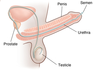 Side view of male reproductive anatomy with erect penis showing path of sperm.