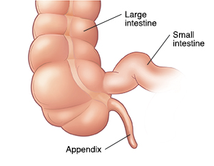 Front view of a normal appendix.