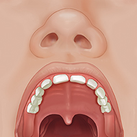 Vista frontal de la boca abierta de un niño donde se ve el paladar normal.