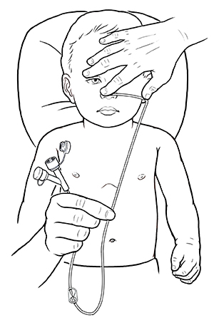 Manos sosteniendo una sonda nasogástrica en la nariz, el oído y el abdomen de un niño pequeño para poder medir el largo adecuado.