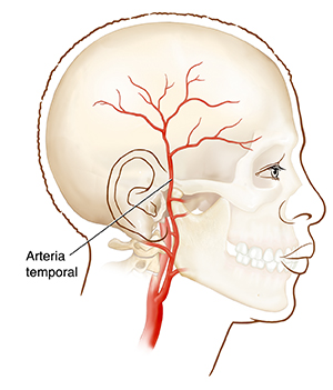 Vista lateral de una cabeza en donde puede verse la arteria temporal.