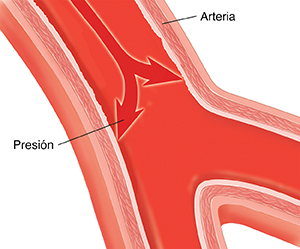 Corte transversal de una arteria con flechas que indican la presión sobre las paredes de las arterias desde el interior.