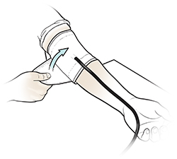 Brazo apoyado sobre una mesa mientras una mano sostiene un manguito colocado en la parte superior del brazo para medir la presión arterial.