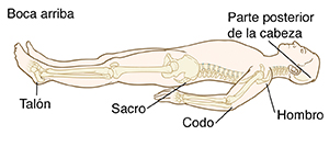 Bosquejo de una persona acostada boca arriba con los huesos visibles. Los puntos de presión: la parte de atrás de la cabeza, el hombro, el codo, el sacro y el talón.