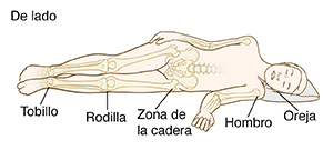 Bosquejo de una persona recostada de lado con los huesos visibles. Los círculos indican los puntos de presión: la oreja, el hombro, la zona de la cadera, las rodillas y el tobillo.