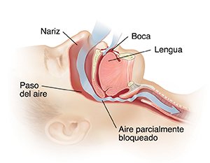 Corte transversal con vista lateral de la cabeza de una persona mientras ronca.