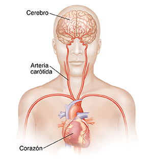 Vista frontal de la cabeza y la parte superior del cuerpo en donde pueden verse las arterias carótidas y el cerebro.